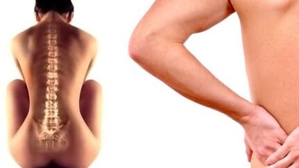 Back pain in the lumbar region. 