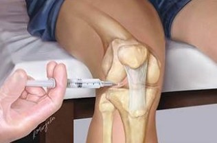 Injection in addition to