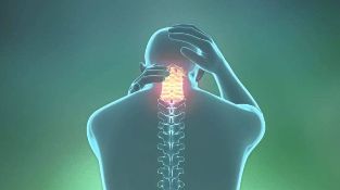 the osteochondrosis of cervical