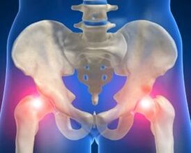 The causes of the osteoarthritis of the hip joint