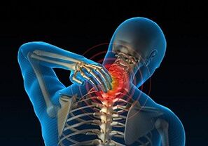 Why does it develop and how cervical osteochondrosis manifests